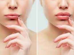 Add definition to your lips with our effective treatments! Everything You Need To Know About Russian Lips Urban You Modern Beauty Wellness