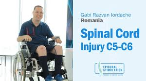 C5 C6 Spinal Cord Injury Patient Gabi From Romania Makes Great Progress After Epidural Stimulation Youtube