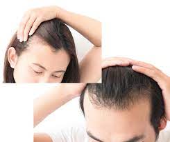 استعمال الزيوت بكثرة للشعر الخفيف أو الناعم يجعل الشعر يبدو ملتصقا بالرأس ومنظرة قريب من الشعر المزيت الشعر الخفيف أو الناعم ear tattoo behind ear tattoo ear