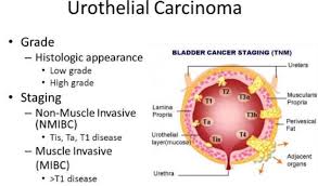 How Cancer Changed My Life Sarah Andrew By Sarah Andrew Medium