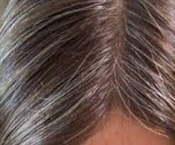 Gray hair is considered as the most embarrassing features it is obviously possible to darken your hair at home without using any chemical based products. à¤¸à¤« à¤¦ à¤¬ à¤² à¤¸ à¤• à¤¸ à¤› à¤Ÿà¤• à¤° à¤ª à¤ White Hair Treatment In Hindi