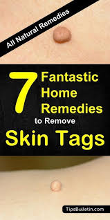 7 Fantastic Home Remedies To Remove Skin Tags Skin Tag Removal Skin Tags On Face Skin Tag