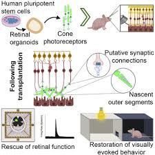 Check spelling or type a new query. Restoration Of Visual Function In Advanced Disease After Transplantation Of Purified Human Pluripotent Stem Cell Derived Cone Photoreceptors Sciencedirect