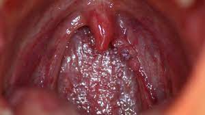 It is pretty much impossible to say that afaik. What Are The Symptoms Of Hpv In Women Signs Testing And Treatment