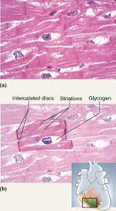This Photo Displays Cardiac Muscle Tissue This Tissue Type Is Striated Branched And Has 1 2 N Medical Laboratory Science Tissue Biology Smooth Muscle Tissue