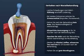 Eine (erfolgreich durchgeführte) wurzelbehandlung hat folgende vorteile zumindest alle zwei jahre sollte auch ein röntgen von allen zähnen gemacht werden. Wurzelbehandlung Das Richtige Verhalten Danach