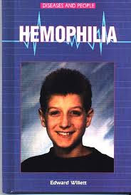 Few famous people with hemophilia are as follows: The Holy Grail Of Hemophilia Treatment Edward Willett