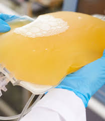 Image result for Plasma Transfusion