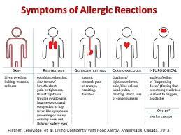 Dr Michael Pistiner On Twitter Symptoms Of Allergic Reaction Anaphylaxis Allergies