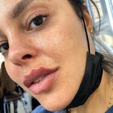 So apparently “Octopus” lips are the next big thing .... What does everyone  think ? Could you see yourself coming in for a treatment ?