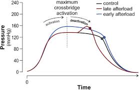 Image result for Afterload