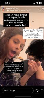 Friendly reminder people with gp can tolerate food by mouth”. Kaya and co.  found food that are gp safe including cheesy pasta. : r/illnessfakers