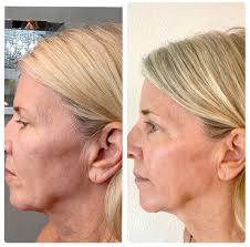 Aesthetics By Desiree