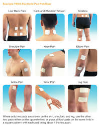 We did not find results for: Where Do I Place The Electrodes For Tens Tenscare Tenscare Ltd