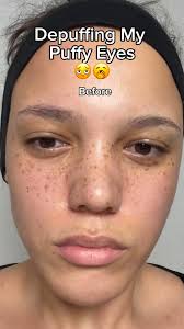 Morning depuffing session ✨👀 Make sure to follow us for more K-beauty ✨  #stylekorean #stylekorean_global #chasinrabbits #koreanskincare #depuffing