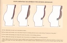 Cibler le bas du ventre : 3 Idees Recues Sur Les Abdos So Busy Girls