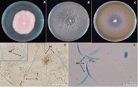 Characterization Of Fusarium Oxysporum Isolates And Resistance Of Passion Fruit Genotypes To Fusariosis