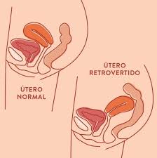Utero Retroverso Flores Rojas Alternativas Menstruales Facebook