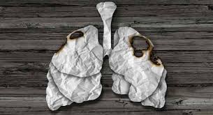 Various factors can cause this mutation to happen. World Cancer Day 5 Key Facts About Lung Cancer In India Thehealthsite Com