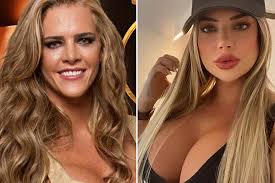 Dermatologistas analisam transformação de Denise Rocha: “Pesou a mão”