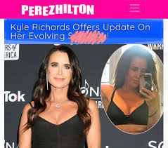 Image result for Richardsiella