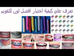 تعرف علي الوان تقويم الاسنان وكيفية التركيب والاختيار karen page success is not final youtube