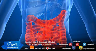 علاج القولون العصبي بالأعشاب الطبيعية Http Www Dailymedicalinfo Com P 74063 Health Fitness Immune Reaction Health