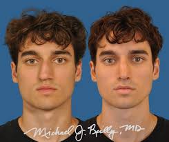 Tough to be saying goodbye today to my fantastic resident, Jason Crossley,  who has been my right-hand man for the last four months. Jason is an  inspiring young surgeon with a tremendous