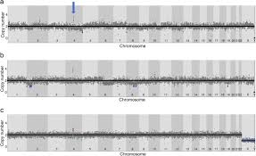 We know when to look outside the box and what to look. Investigation Of Somatic Cnvs In Brains Of Synucleinopathy Cases Using Targeted Snca Analysis And Single Cell Sequencing Acta Neuropathologica Communications Full Text