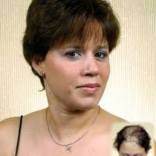 NELLIE GREER'S HAIR LOSS CLINIC