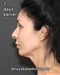 Nayak Plastic Surgery