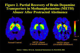 Meth releases so much dopamine at once compared to any other substance by many times over. Availability And Effectiveness Of Programs To Treat Methamphetamine Abuse Nida Archives