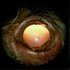 Image result for Mydriasis