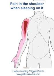 Pin On Pain