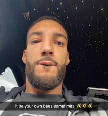 Rudy Gobert's own bee hive stung him 😬 He's still able to play Game 6  tonight vs. the Mavericks