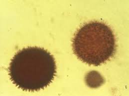 Image result for Melastomastrum segregatum