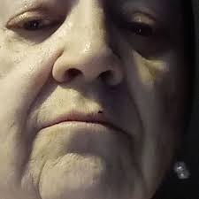 Fundraiser by Judith Rudd Hinkle : Eye surgery help