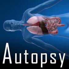 Download autopsy version 4.19.1 for windows. Autopsy For Pc Windows 7 8 10 Mac Dev Buzz