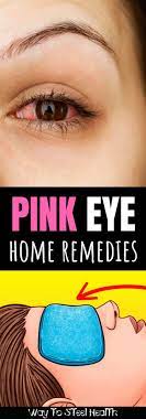 Get Rid Of Pink Eye Fast With These 6 Home Remedies Natural Pink Eye Remedy Pink Eye Home Remedies Pink Eyes
