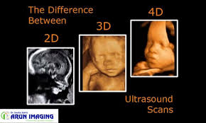 We Believe In Giving The Utmost Care And Satisfaction To Our Patients So They Get No Chance Of Regretting Their Decision Of Vis Ultrasound 4d Ultrasound Scan