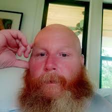 Just ordered the laser pecker LP4 with the roller and the slider part and  the box cover