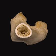 Cross section of a femur bone showing the anatomical structure including cancellous bone and marrow. Bone Cross Section Lm Photograph By Science Stock Photography