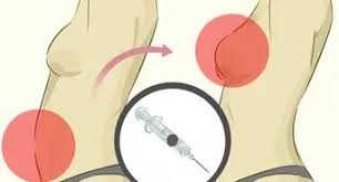 Doch vorstellungen habe ich, angefangen von einem delphin. Mit Einem Neuen Tattoo Duschen 15 Schritte Mit Bildern Wikihow