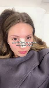 aburrida pero con nariz nueva a win is a win #rinoplastia ✨✨