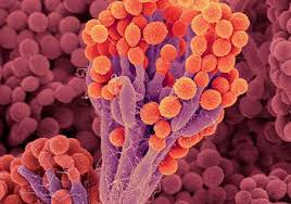 Karena tanaman jagung adalah tanaman yang akan tumbuh baik pada cuaca yang lembap. 35 Contoh Jamur Ascomycota Yang Menguntungkan Dan Merugikan Biologijk