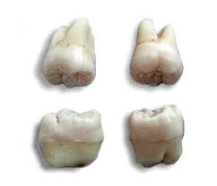 A free online english hindi picture dictionary. Wisdom Tooth Meaning In Hindi