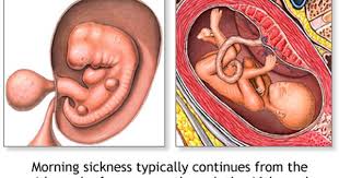 Pin On Pregnancy And Delivery