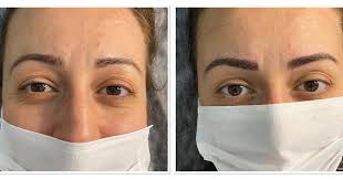 microblading ❤️ 🖊 MERVE AKALIN #kaş #kaştasarım #kalıcımakyaj #micro  #eyeliner #lipgloss #ızmır #lazer #epilasyon #laser #diodelazer