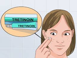 We did not find results for: How To Use Tretinoin And Benzoyl Peroxide Concurrently 12 Steps