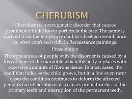 It is characteristic of cherubism healing lesions show: Cherubism Cherubism Is A Rare Genetic Disorder That Causes Prominence In The Lower Portion In The Face The Name Is Derived From The Temporary Chubby Cheeked Ppt Video Online Download